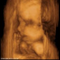 obraz ultrazvuku